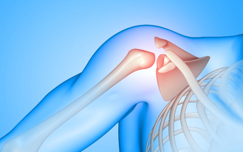 artroscopia de hombro